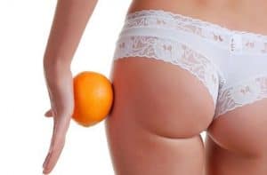 Cellulit - jak się go pozbyć cellulit domowe sposoby, cellulit jak się go pozbyć, cellulit ćwiczenia, cellulit dieta, cellulit masaże